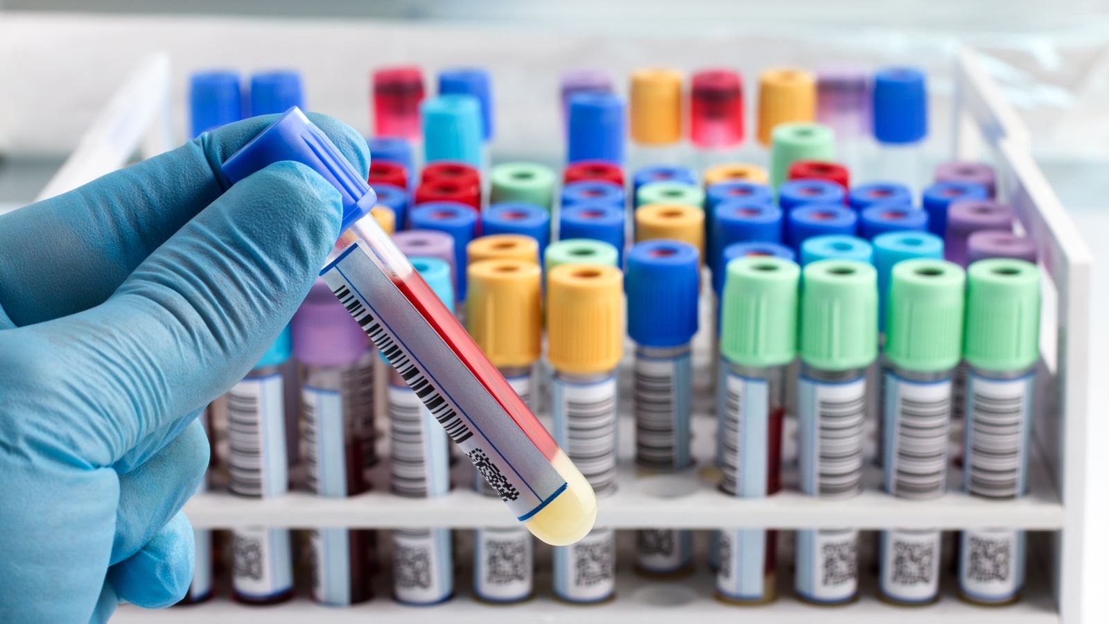 Die SwiSCI Biobank – Eine Investition in die Zukunft